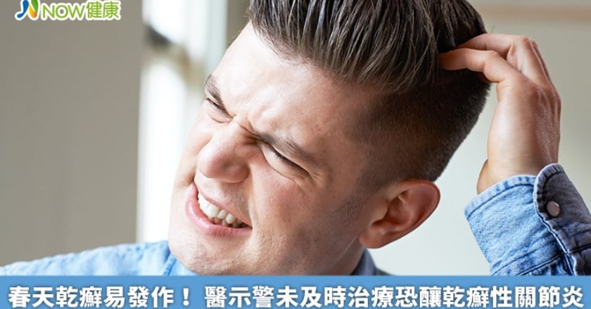 春天乾癬易發作！ 醫示警未及時治療恐釀乾癬性關節炎