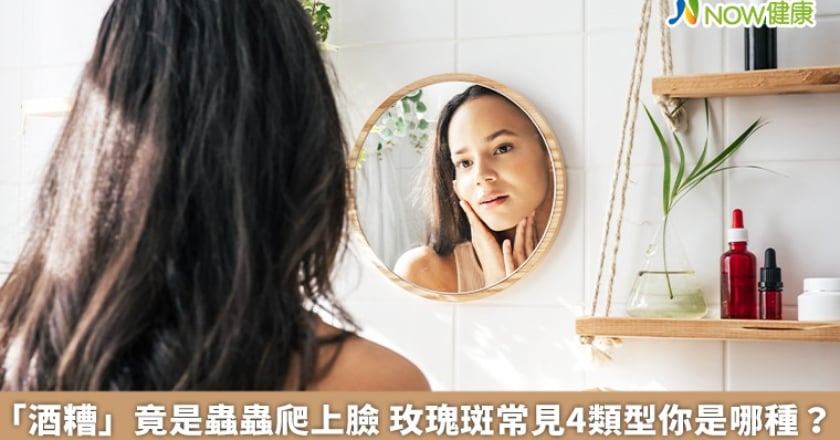 「酒糟」竟是蟲蟲爬上臉 玫瑰斑常見4類型你是哪種?