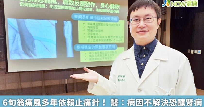 6旬翁痛風多年依賴止痛針！ 醫：病因不解決恐釀腎病