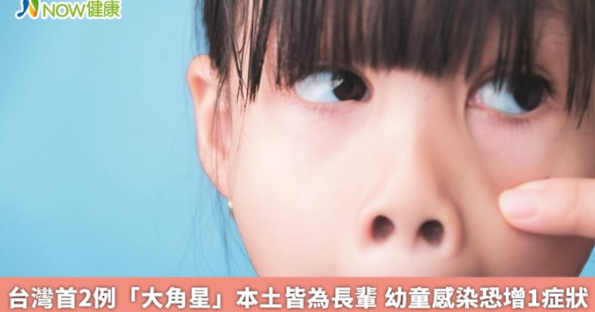 台灣首2例「大角星」本土皆為長輩 幼童感染恐增1症狀