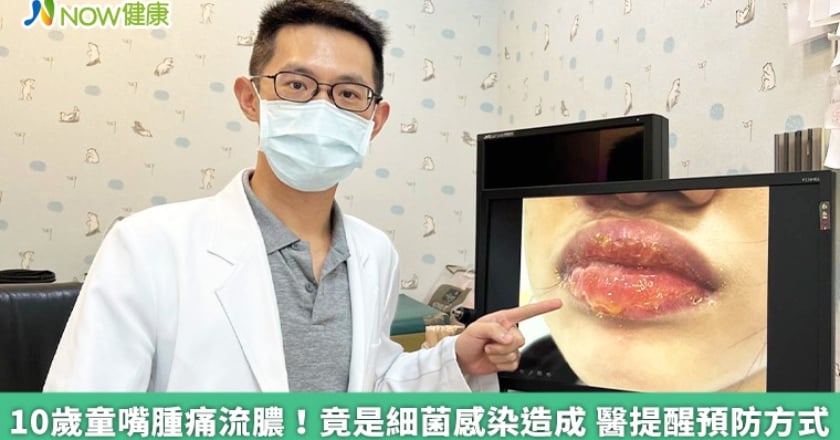 10歲童嘴腫痛流膿！竟是細菌感染造成 醫提醒預防方式