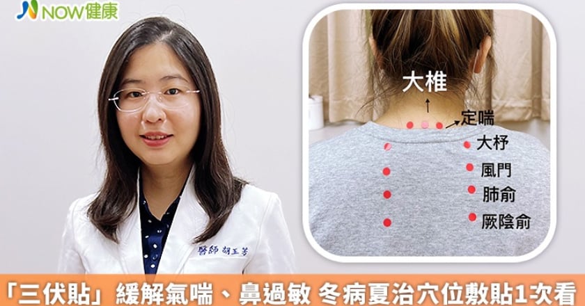 「三伏貼」緩解氣喘、鼻過敏 冬病夏治穴位敷貼1次看