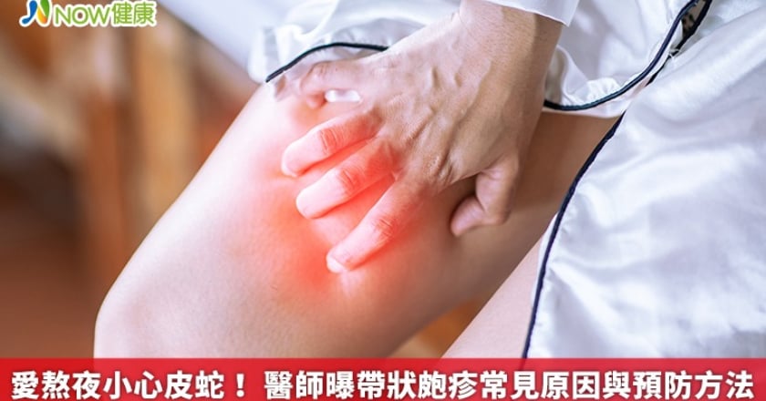 愛熬夜小心皮蛇！ 醫師曝帶狀皰疹常見原因與預防方法