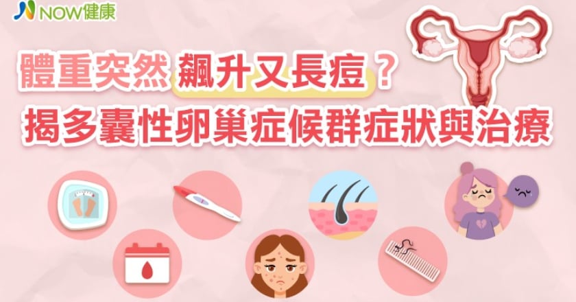 體重突然飆升又長痘？ 揭多囊性卵巢症候群症狀與治療