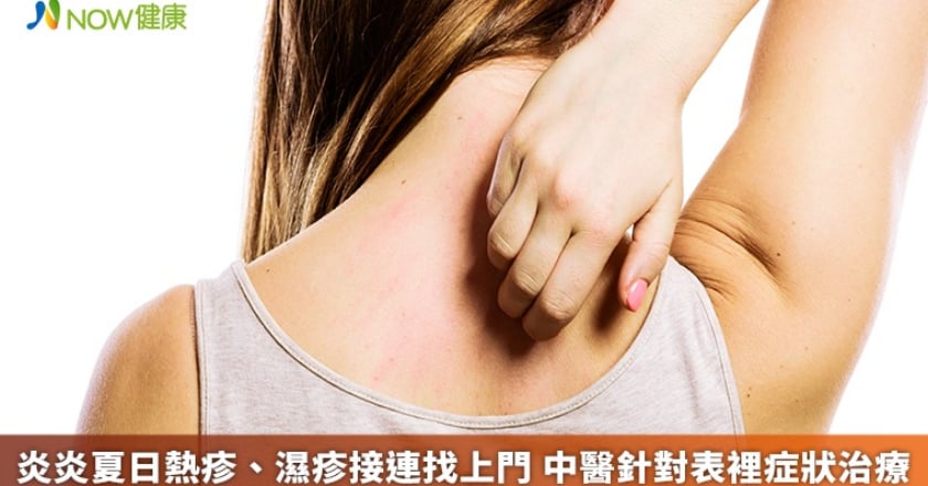 炎炎夏日熱疹、濕疹接連找上門 中醫針對表裡症狀治療