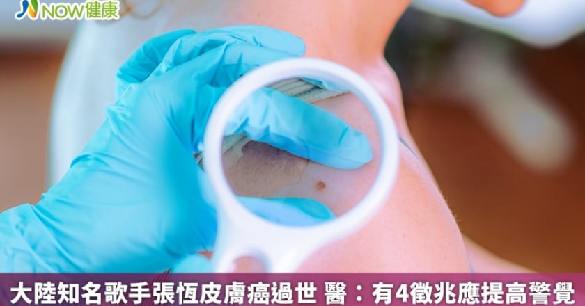 大陸知名歌手張恆遠皮膚癌過世 醫：有4徵兆應提高警覺