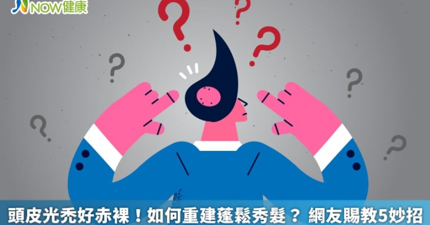 頭皮光禿好赤裸!如何重建蓬鬆秀髮? 網友賜教5妙招