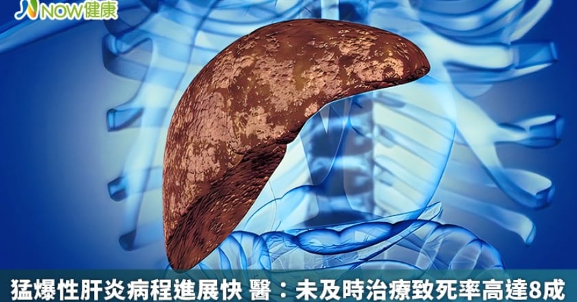 猛爆性肝炎病程進展快 醫:未及時治療致死率高達8成