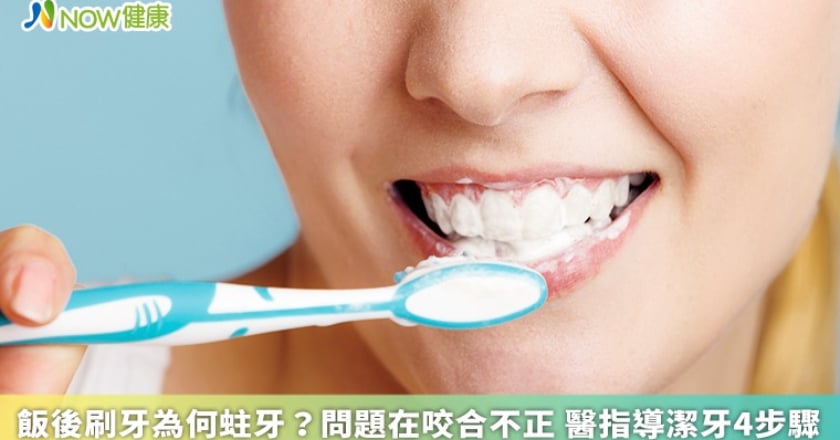 飯後刷牙為何蛀牙？問題在咬合不正 醫指導潔牙4步驟