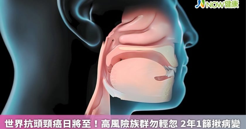 世界抗頭頸癌日將至!高風險族群勿輕忽 2年1篩揪病變