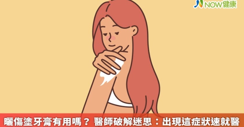曬傷塗牙膏有用嗎? 醫師破解迷思:出現這症狀速就醫