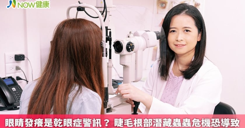 眼睛發癢是乾眼症警訊？ 睫毛根部潛藏蟲蟲危機恐導致