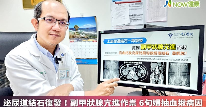 泌尿道結石復發!副甲狀腺亢進作祟 6旬婦抽血揪病因