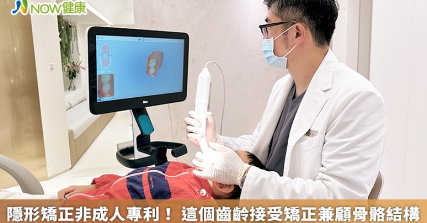 隱形矯正非成人專利！ 這個齒齡接受矯正兼顧骨骼結構
