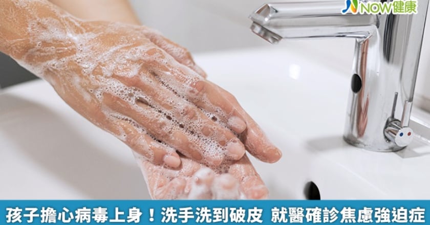 孩子擔心病毒上身！洗手洗到破皮 就醫確診焦慮強迫症