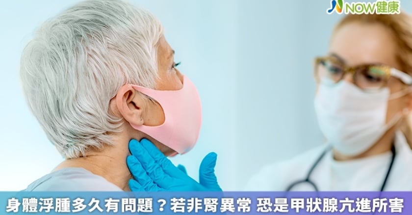 身體浮腫多久有問題？若非腎異常 恐是甲狀腺亢進所害