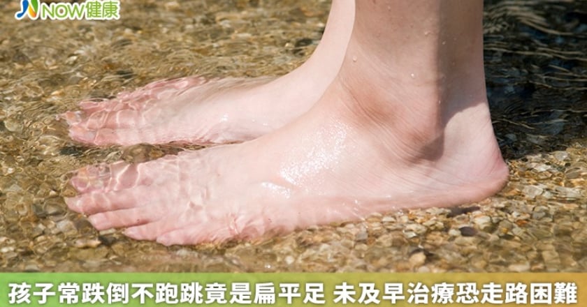 孩子常跌倒不愛跑跳竟是扁平足 未及早治療恐走路困難