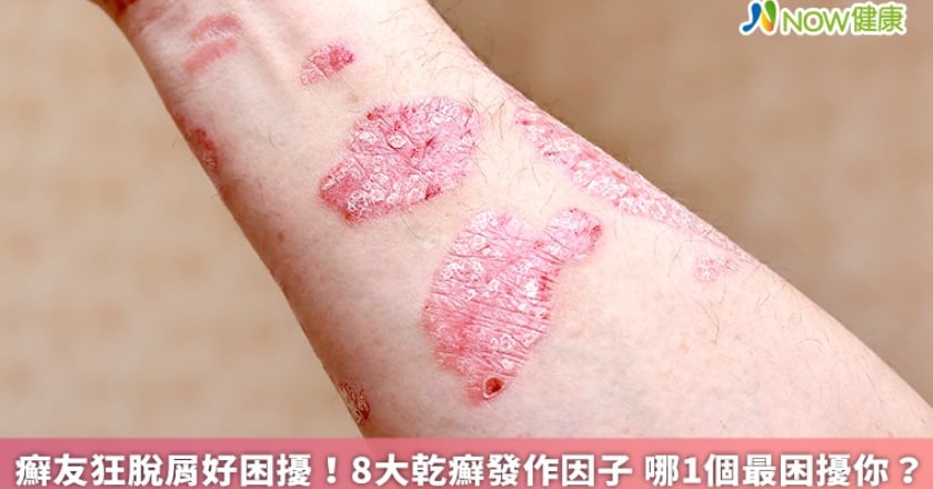 癬友狂脫屑好困擾！8大乾癬發作因子 哪1個最困擾你？