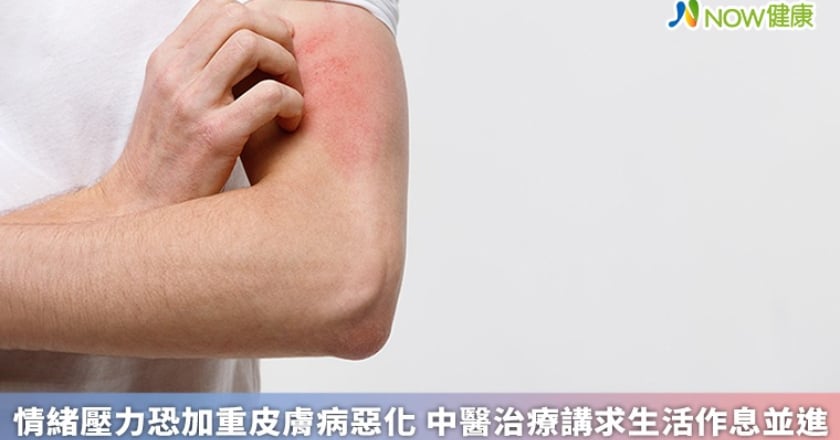 情緒壓力恐加重皮膚病惡化 中醫治療講求生活作息並進