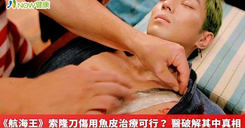 《航海王》索隆刀傷用魚皮治療可行？ 醫破解其中真相