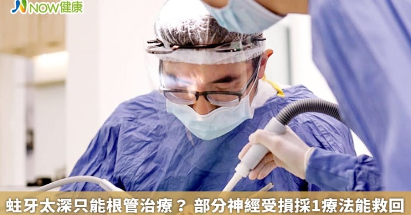 蛀牙太深只能根管治療？ 部分神經受損採1療法能救回