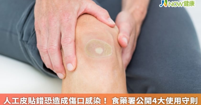 人工皮貼錯恐造成傷口感染! 食藥署公開4大使用守則
