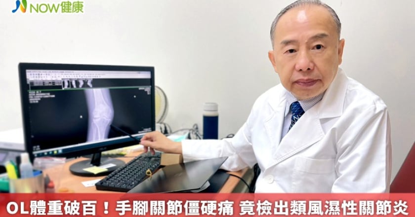 OL體重破百！手腳關節僵硬痛 竟檢出類風濕性關節炎