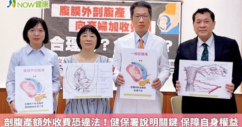 剖腹產額外收費恐違法!健保署說明關鍵 保障自身權益