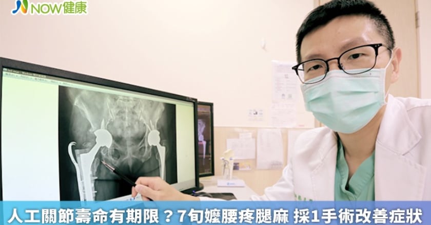 人工關節壽命有期限？7旬嬤腰疼腿麻 採1手術改善症狀