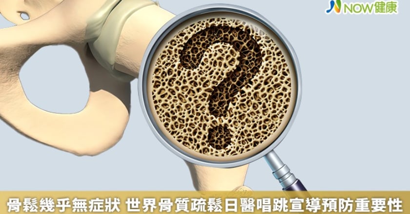 骨鬆幾乎無症狀 世界骨質疏鬆日醫唱跳宣導預防重要性