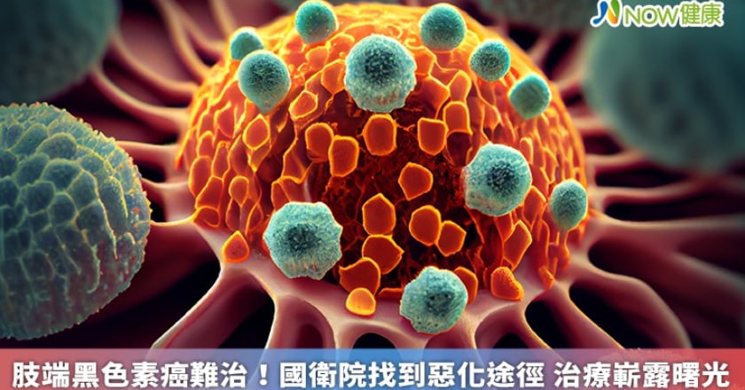 肢端黑色素癌難治！國衛院找到惡化途徑 治療嶄露曙光