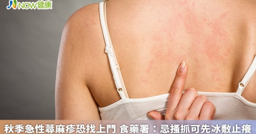 秋季急性蕁麻疹恐找上門 食藥署：忌搔抓可先冰敷止癢