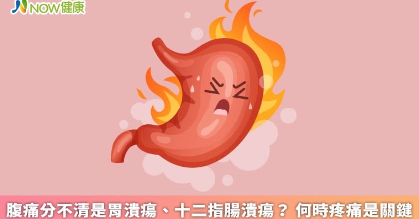 腹痛分不清是胃潰瘍、十二指腸潰瘍？ 何時疼痛是關鍵