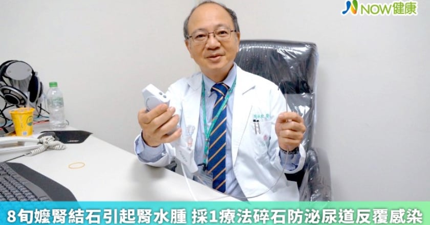 8旬嬤腎結石引起腎水腫 採1療法碎石防泌尿道反覆感染