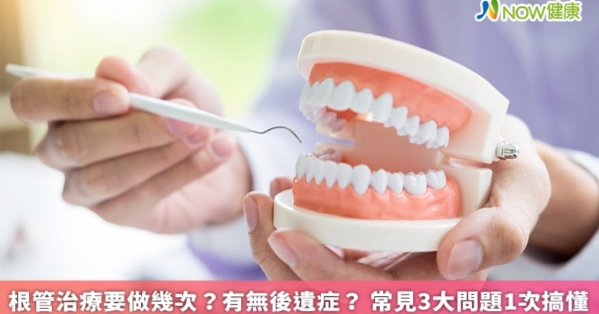 根管治療要做幾次？有無後遺症？ 常見3大問題1次搞懂