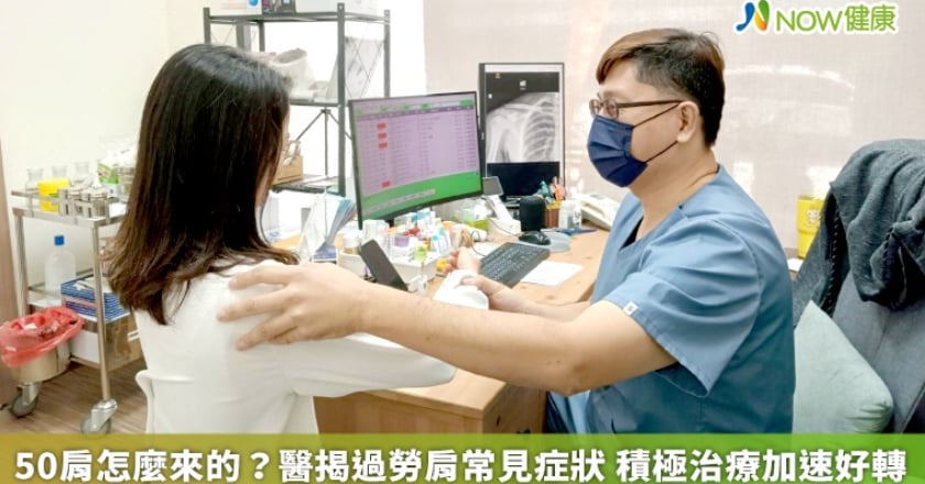 50肩怎麼來的？醫揭過勞肩常見症狀 積極治療加速好轉