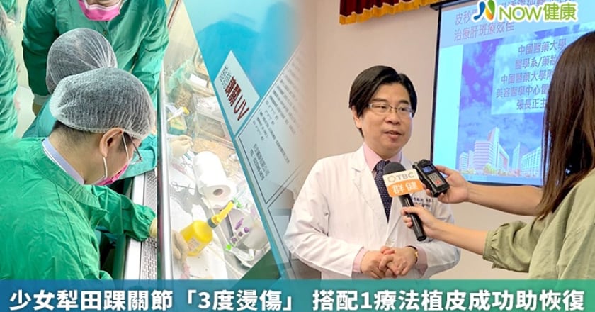 少女犁田踝關節「3度燙傷」 搭配1療法植皮成功助恢復