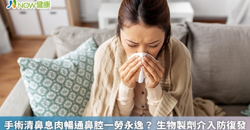 手術清鼻息肉暢通鼻腔一勞永逸？ 生物製劑介入防復發