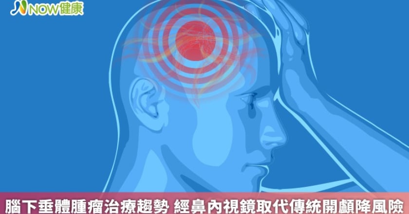 腦下垂體腫瘤治療趨勢 經鼻內視鏡取代傳統開顱降風險