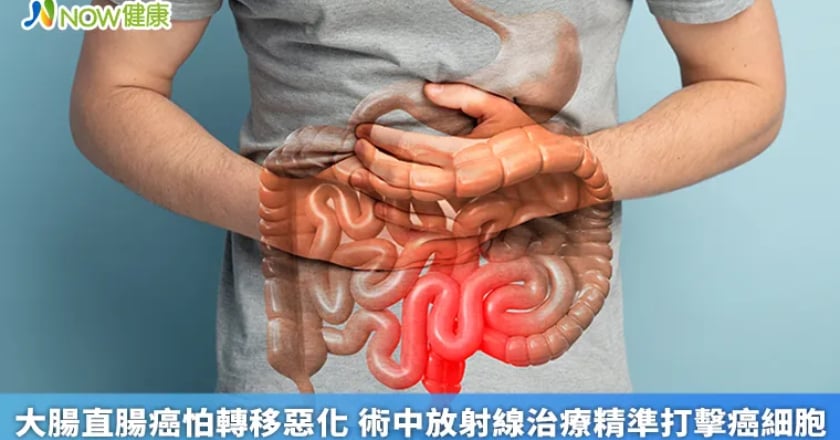 大腸直腸癌怕轉移惡化 術中放射線治療精準打擊癌細胞