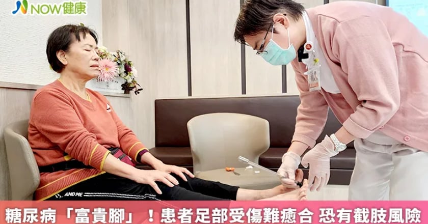 糖尿病「富貴腳」！患者足部受傷難癒合 恐有截肢風險