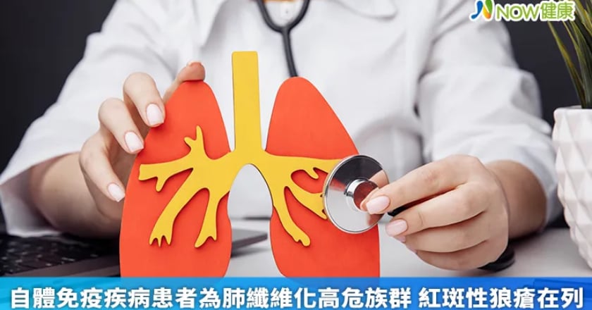 自體免疫疾病患者為肺纖維化高危族群 紅斑性狼瘡在列
