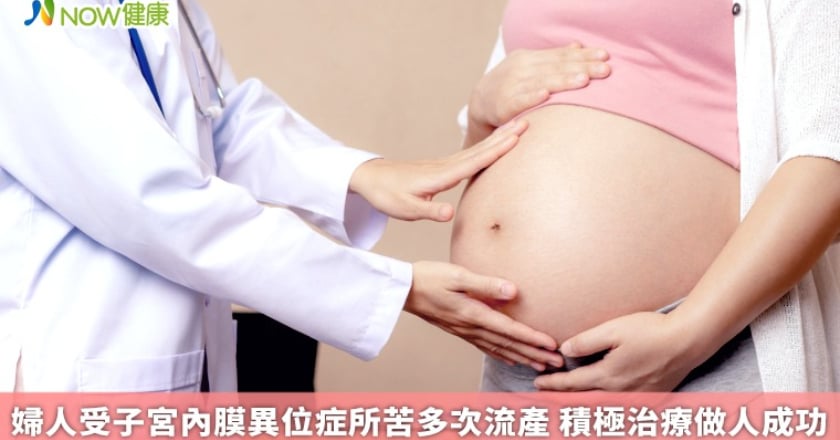 婦人受子宮內膜異位症所苦多次流產 積極治療做人成功