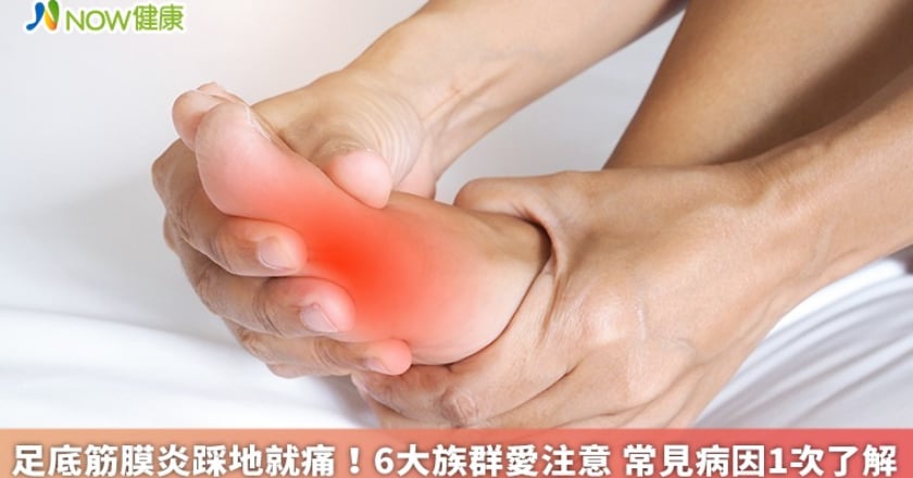 足底筋膜炎踩地就痛!6大族群愛注意 常見病因1次了解
