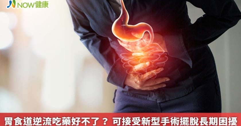 胃食道逆流吃藥好不了? 可接受新型手術擺脫長期困擾