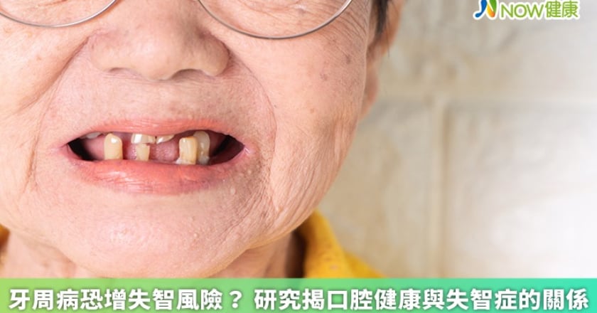 牙周病恐增失智風險？ 研究揭口腔健康與失智症的關係