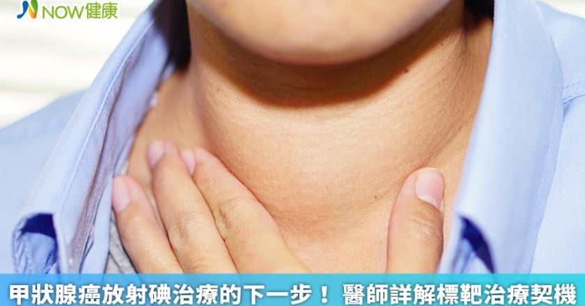 甲狀腺癌放射碘治療的下一步！ 醫師詳解標靶治療契機