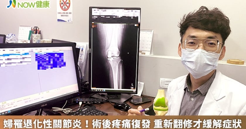 婦罹退化性關節炎!術後疼痛復發 重新翻修才緩解症狀