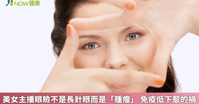 美女主播眼瞼不是長針眼而是「腫瘤」 免疫低下惹的禍