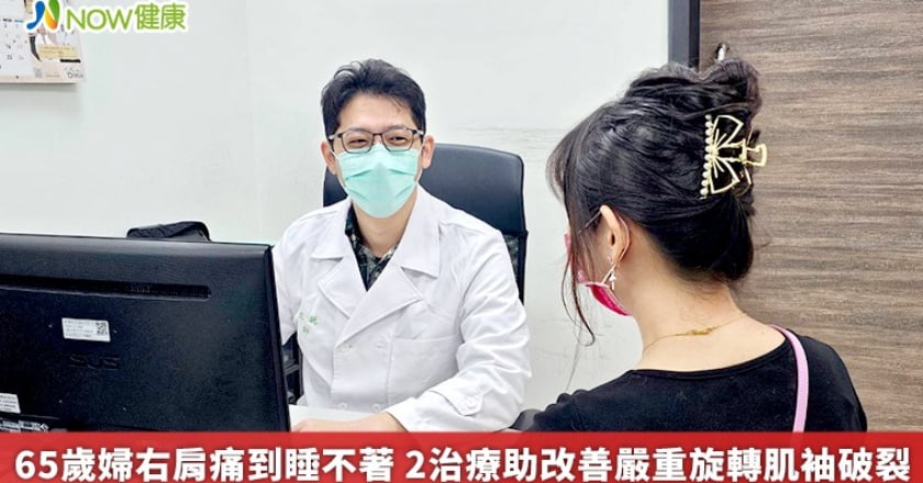 65歲婦右肩痛到睡不著 2治療助改善嚴重旋轉肌袖破裂
